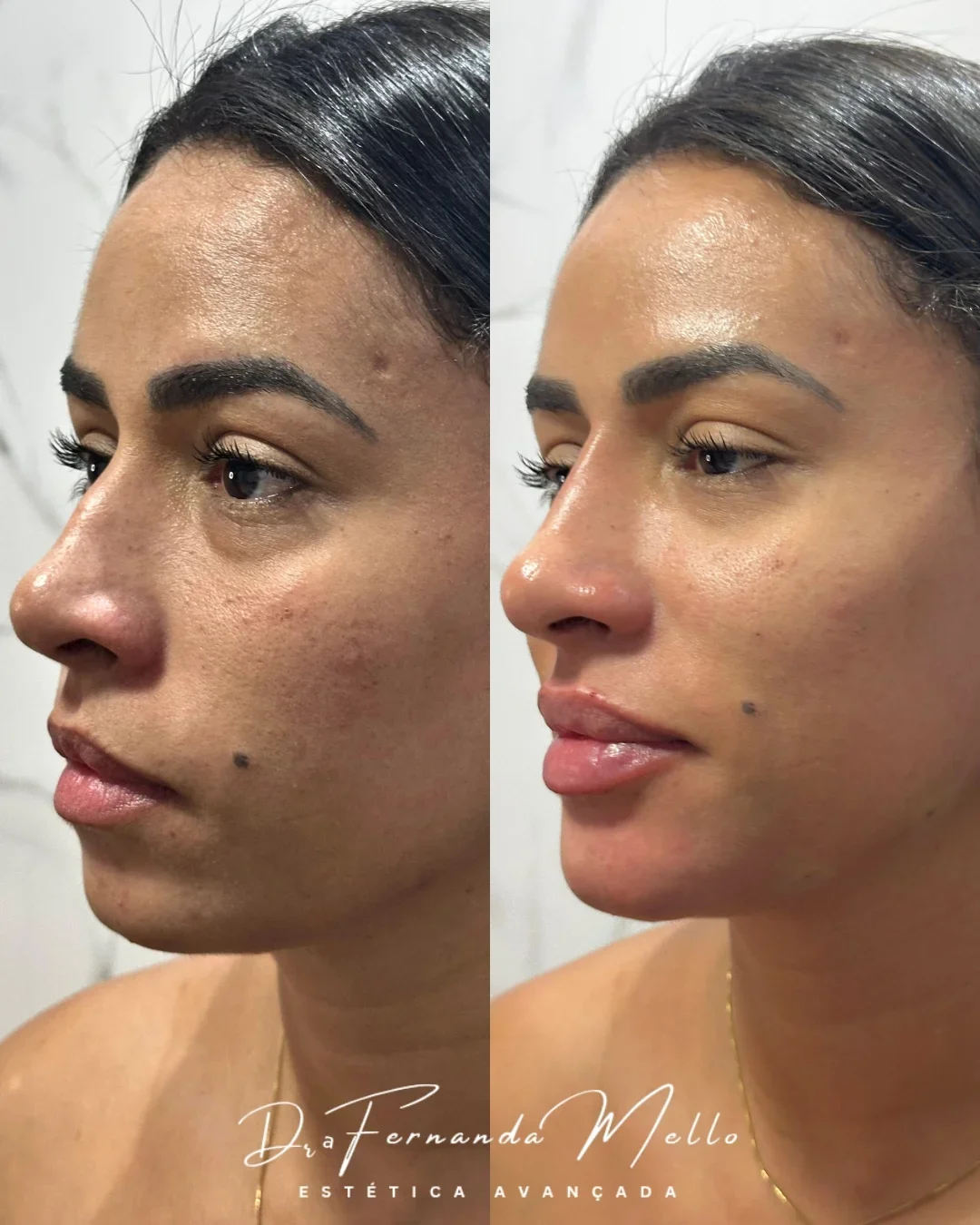 Antes e Depois 1