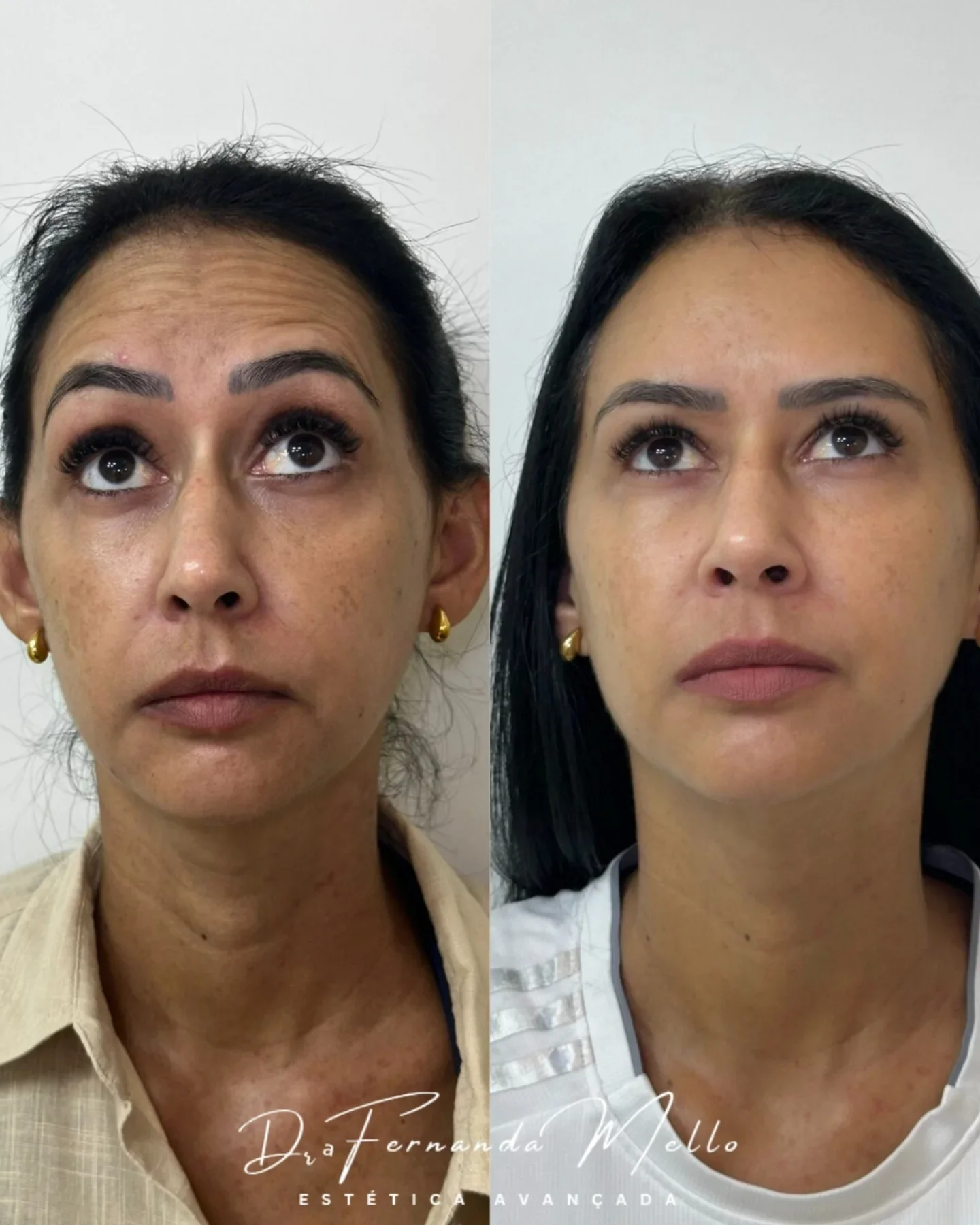 Antes e Depois 12
