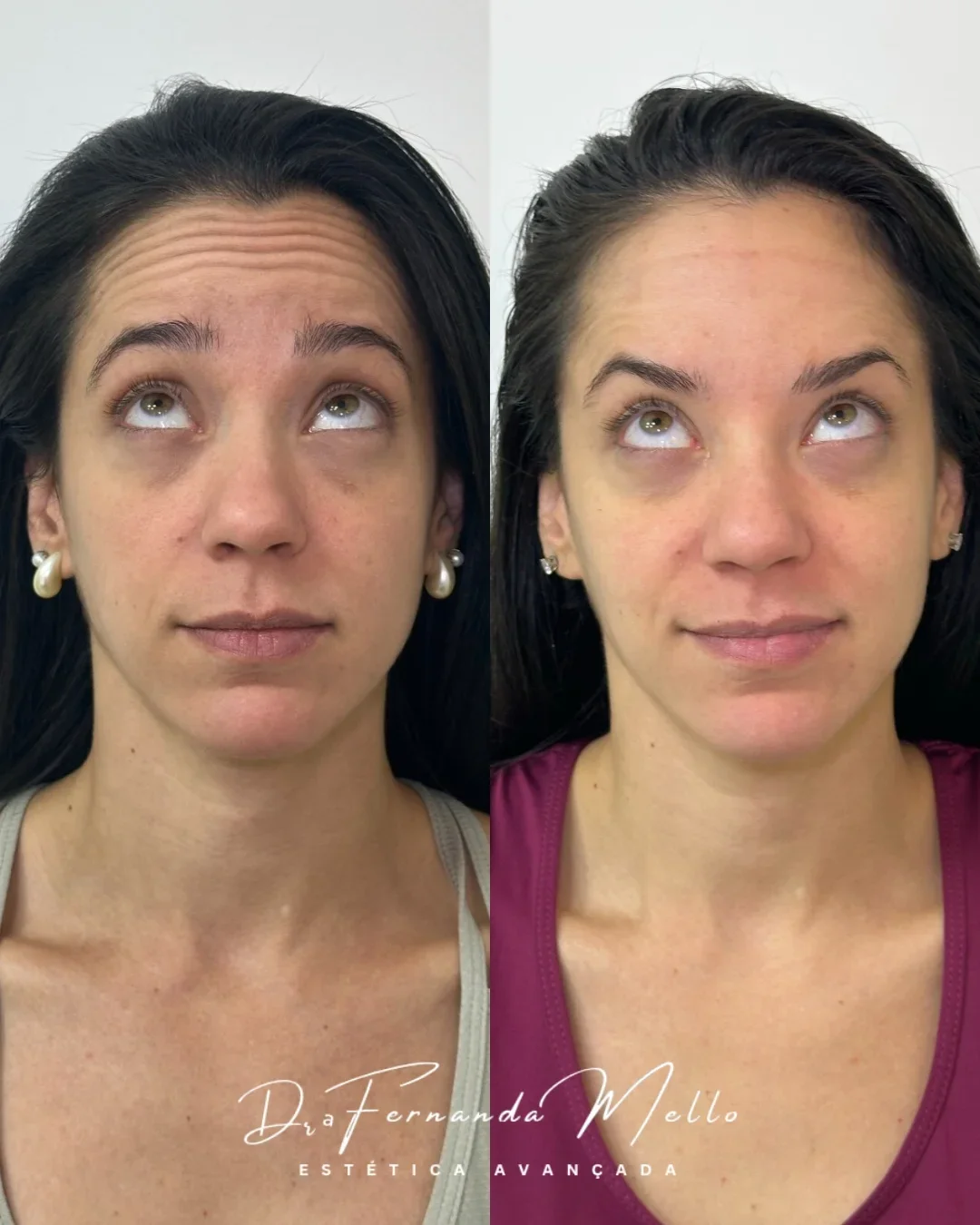 Antes e Depois 16