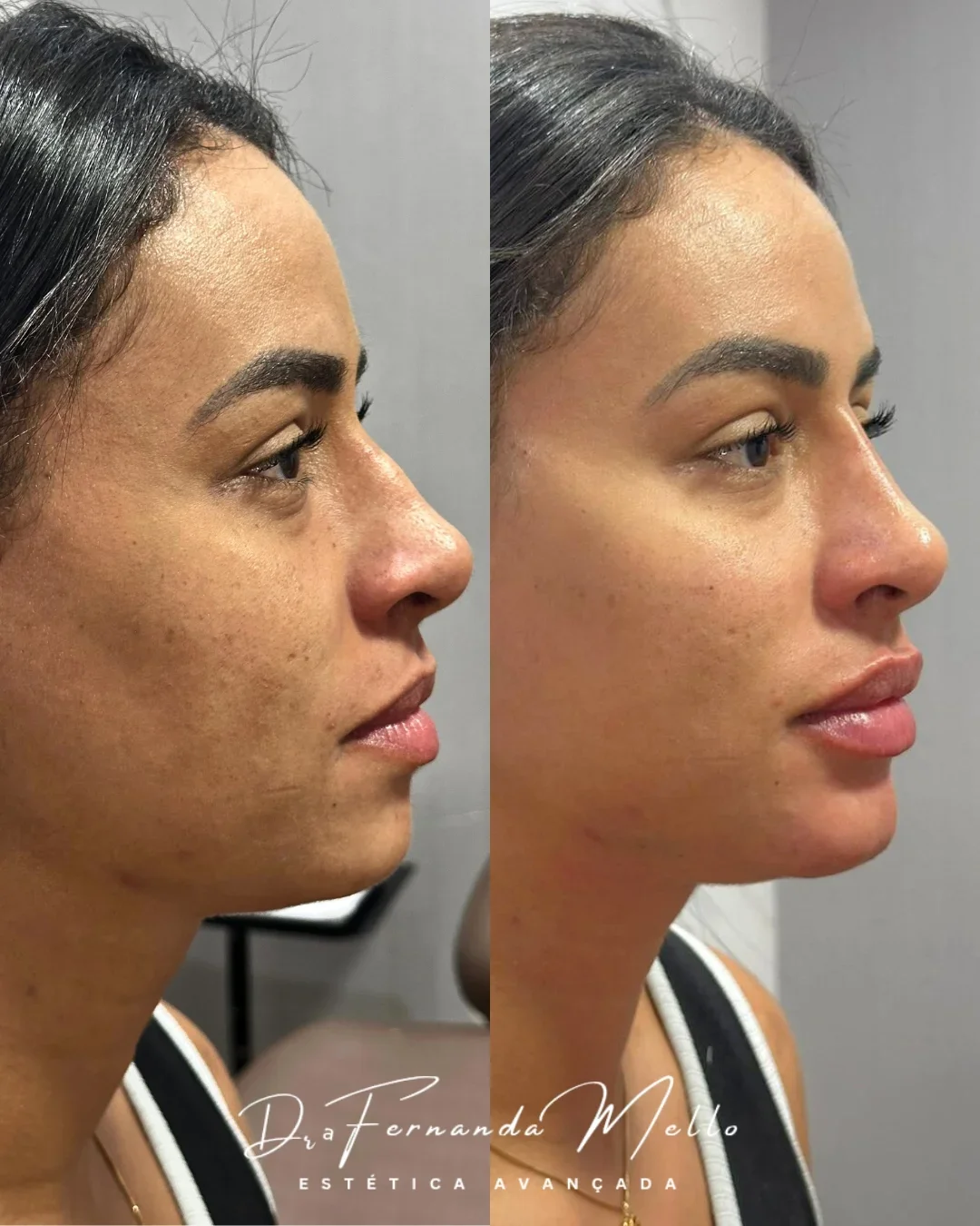 Antes e Depois 2