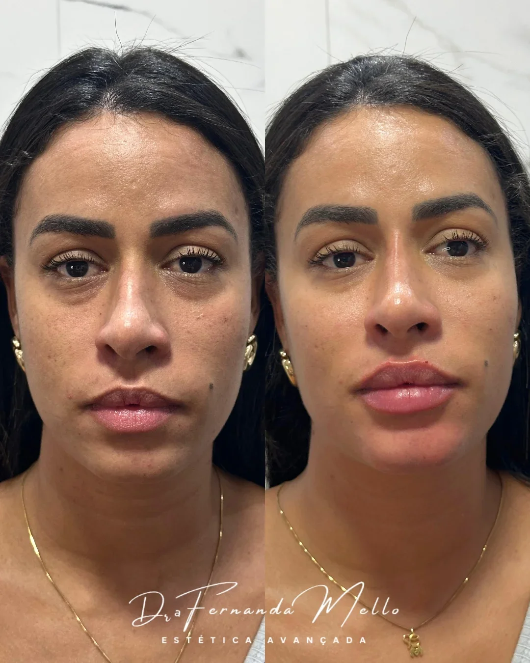 Antes e Depois 3