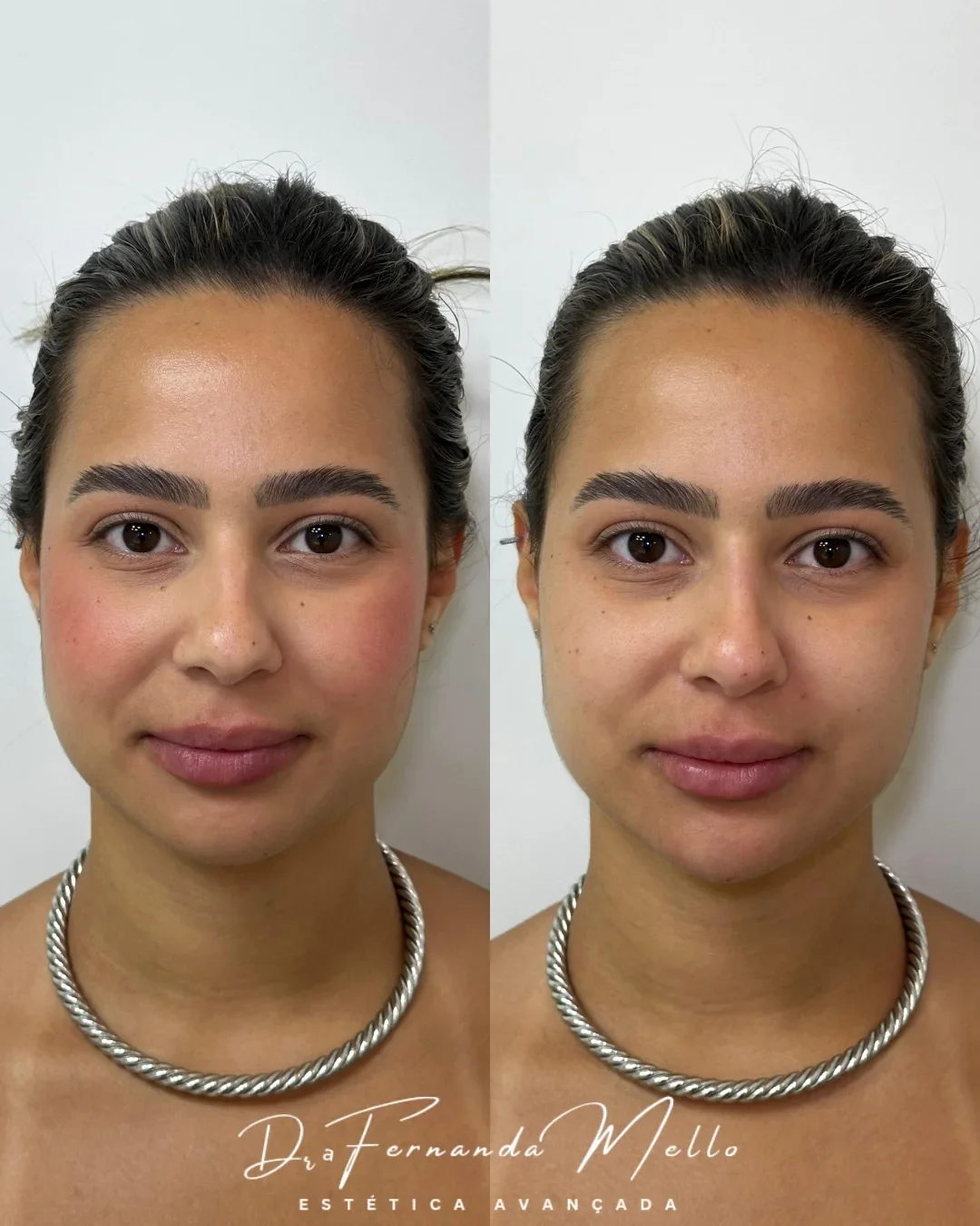 Antes e Depois 6