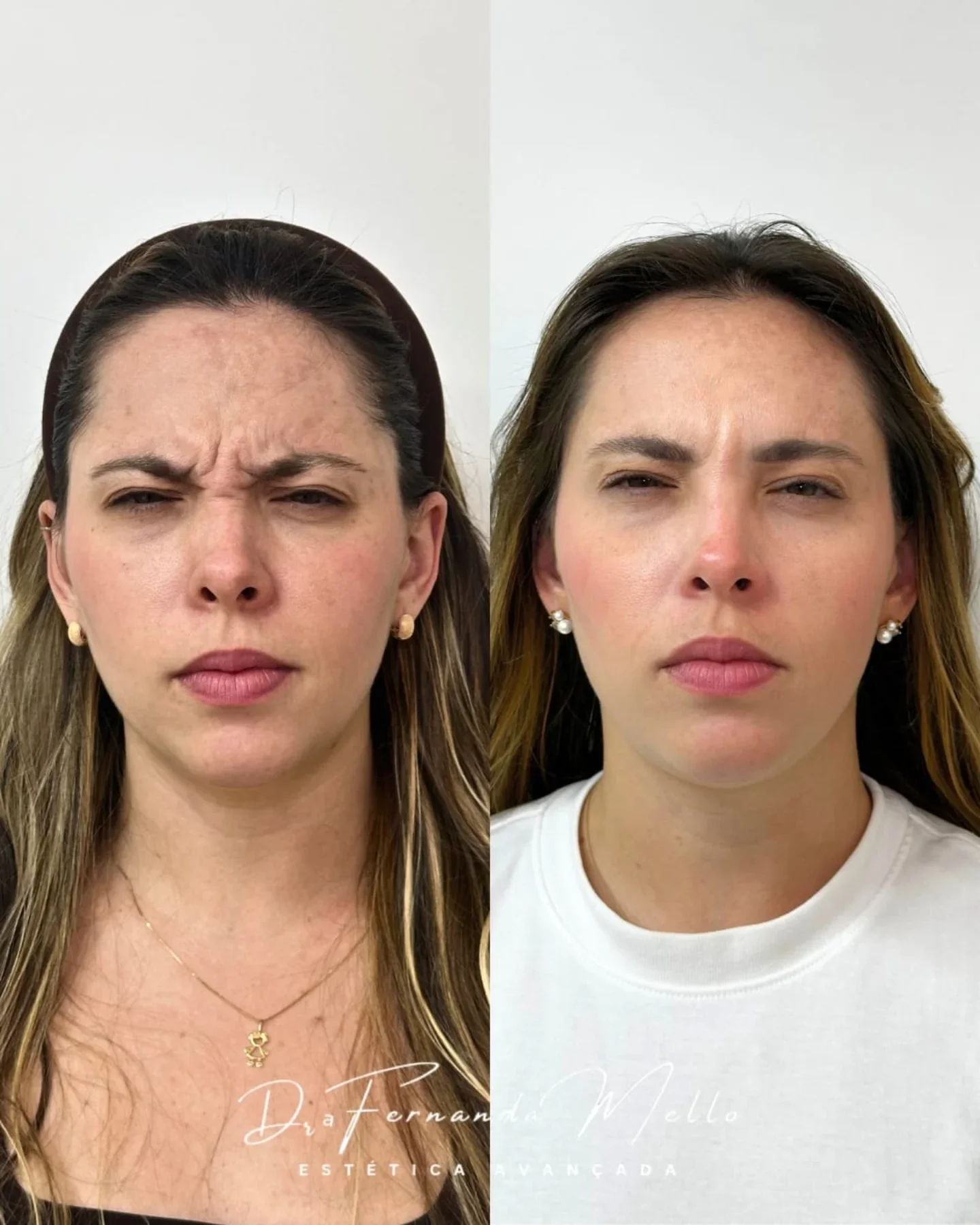 Antes e Depois 8