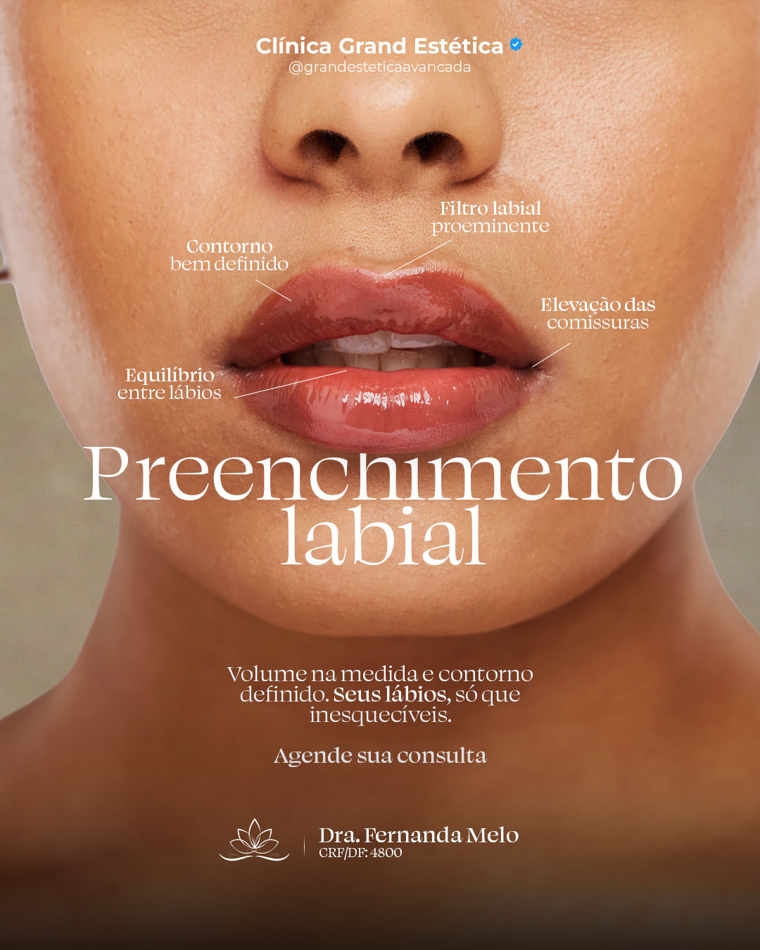 Procedimentos Grand Estética